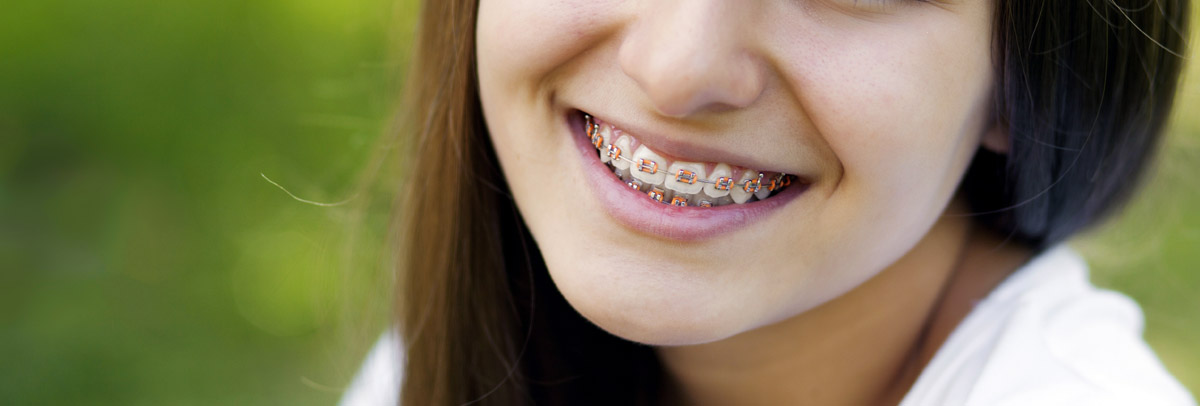 Traitements d'orthodontie enfant et adolescent