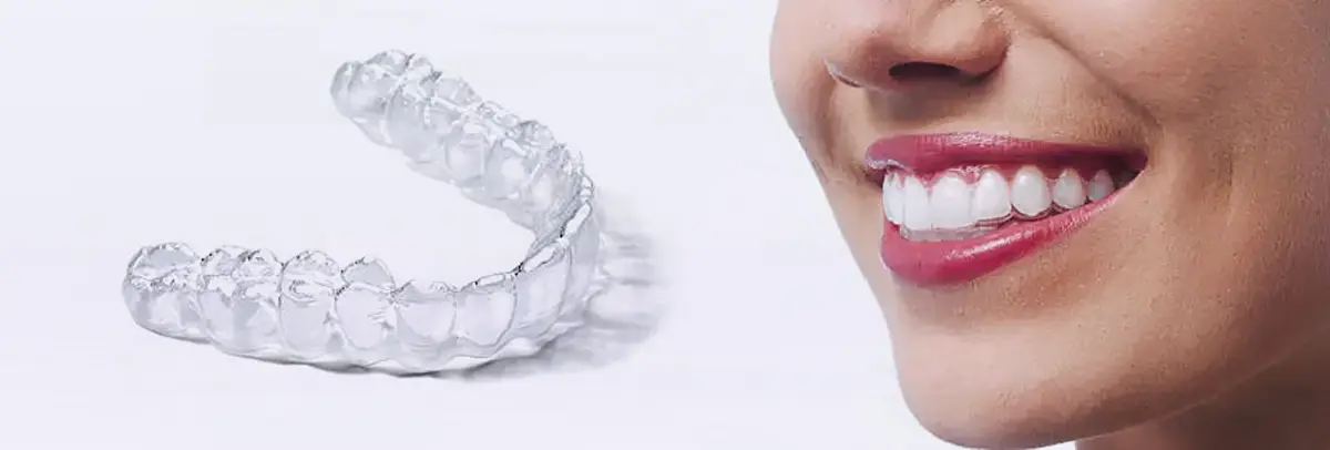 Gouttières Dentaires Transparentes Invisalign