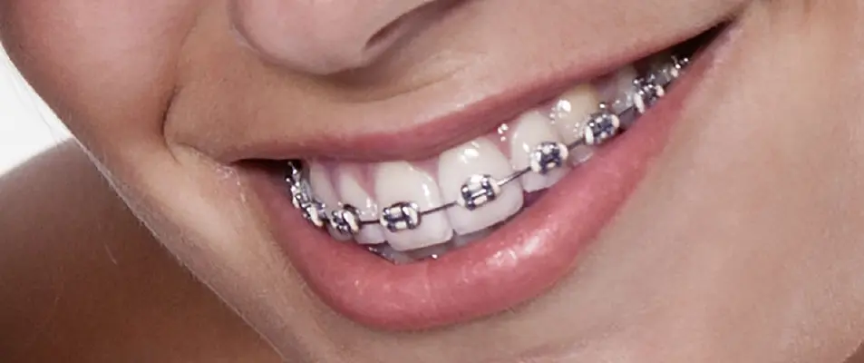 But de l’orthodontie