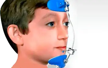 Masque de Delaire : Appareil Dentaire Enfant
