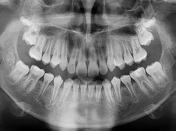 Radiographie Cabinet d'Orthodontie