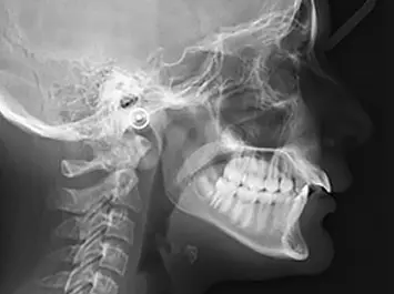Radiographie Orthodontie Paris